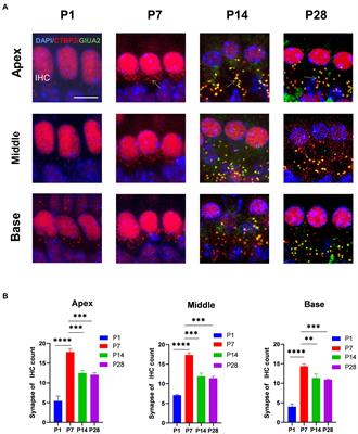 Cochlear resident macrophage mediates development of ribbon synapses via CX3CR1/CX3CL1 axis